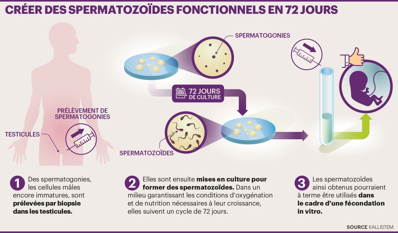Sante Des Spermatozoides Fabriques In Vitro Le Parisien