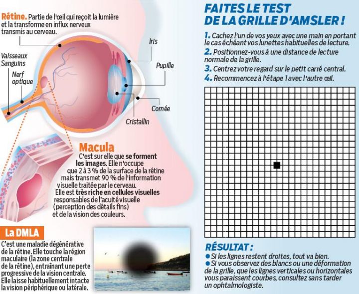 Sachez tout sur la DMLA Le